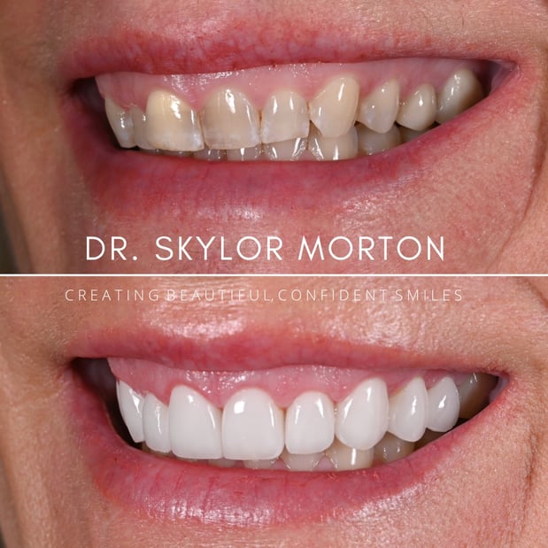 Images Nashville Wisdom Teeth and Implant Solutions