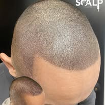 Images The Scalp Master