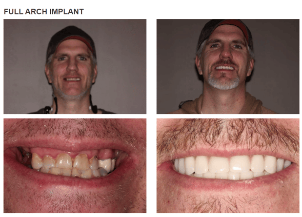 Images Roy Dental Care