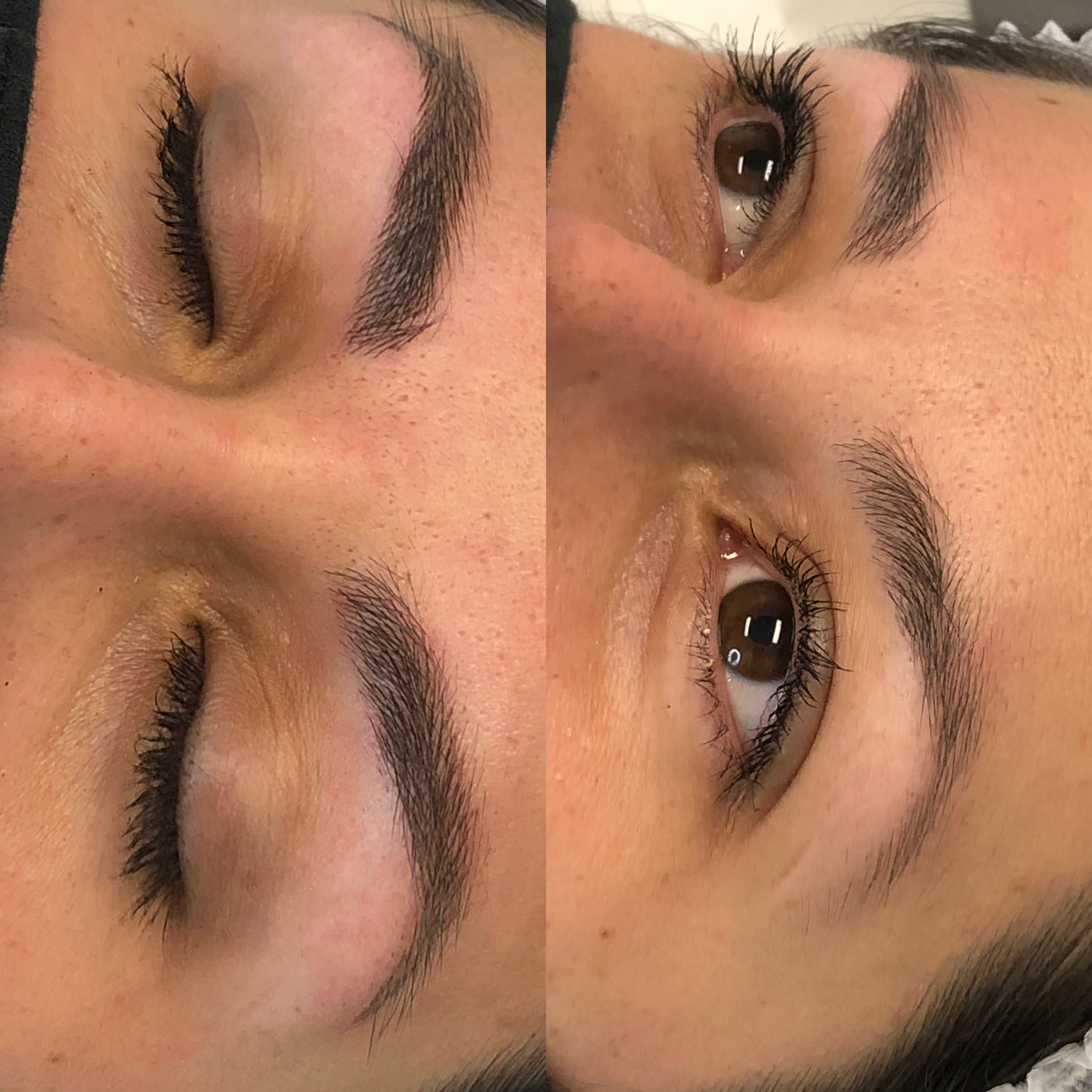 Images Clinique d'Esthétique Leila - Hydrafacial, Microblading, Épilation Laser Sainte-Foy