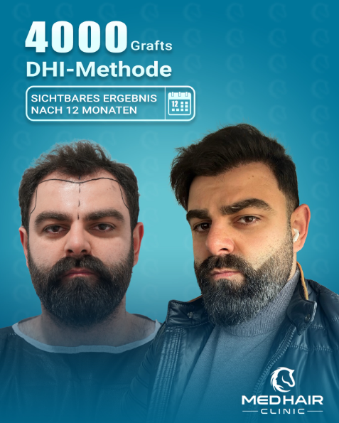 MedHair Clinic | Niederlassung Berlin | Haartransplantation Türkei, Silvio Meier Strasse 2 in Berlin