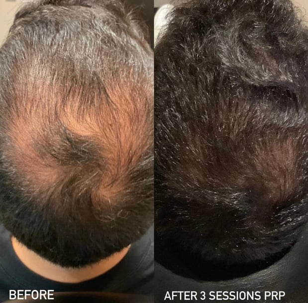 Images Beverly Wilshire Aesthetics Beverly Hills Medical Spa for Botox, Morpheus8, IPL, Lip Fillers