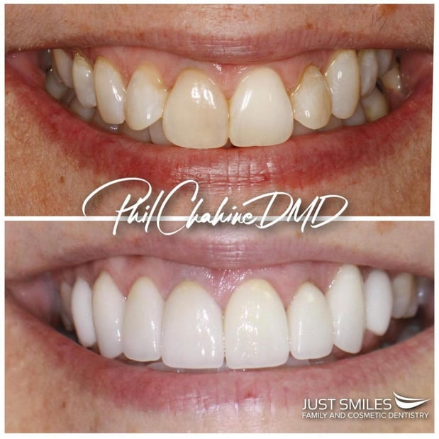 Images Just Smiles - General, Cosmetic & Implant Dentistry