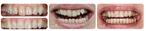Images Aspire Dental Care PLLC