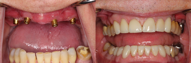 Images Cosmetic and Implant Dentistry of Connecticut