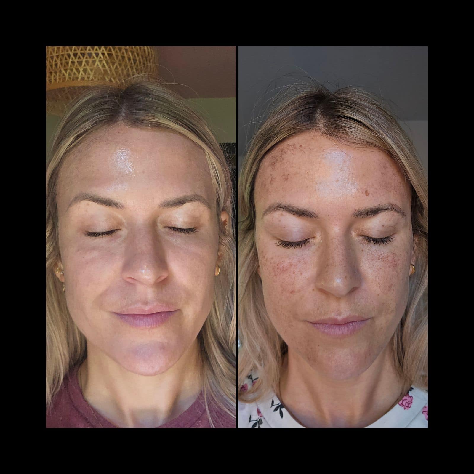 Images MKN Esthétique Laser & Bien-être