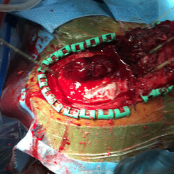 Yashar Neurosurgery Photo