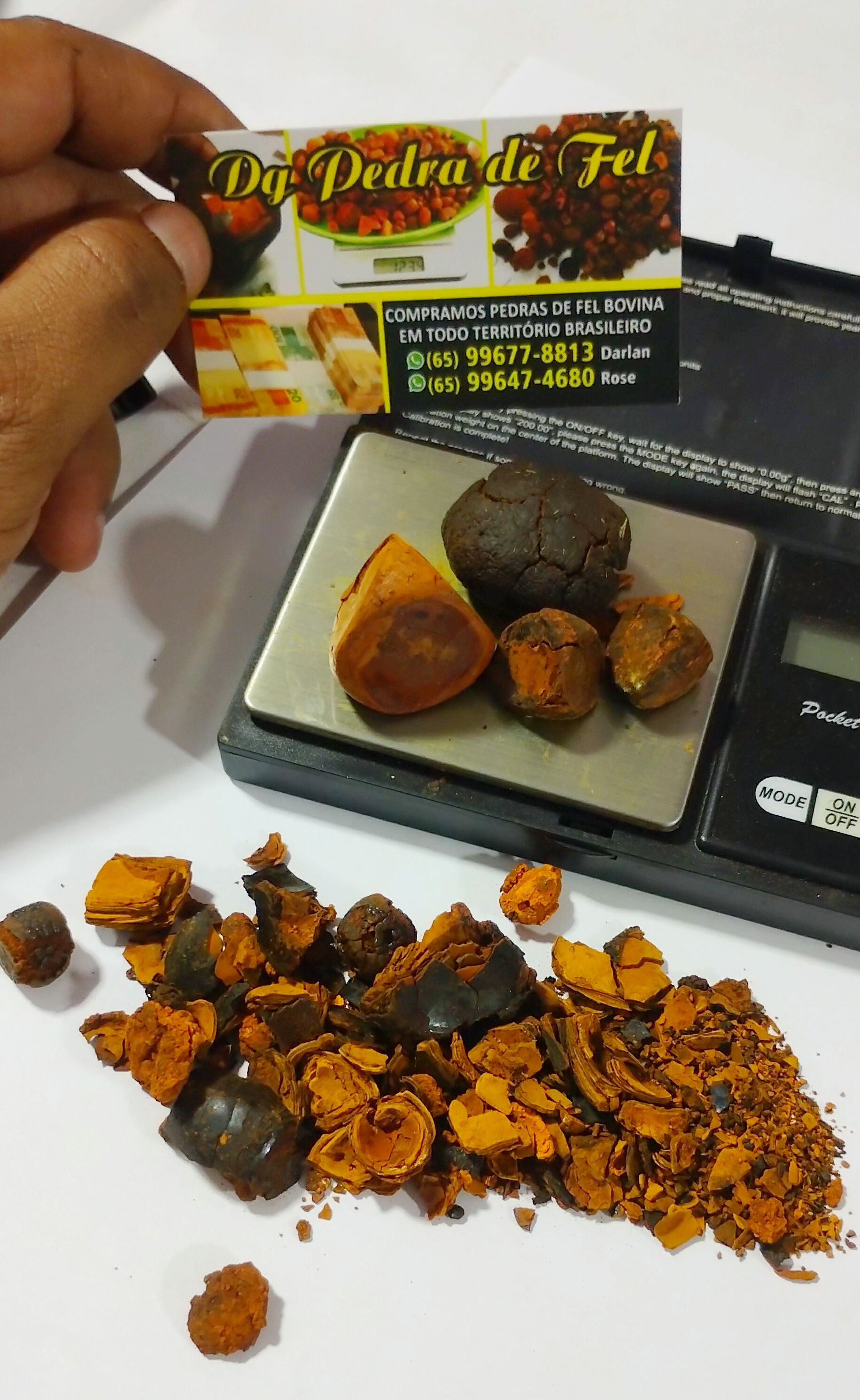 Images Dg pedras de fel bovinos