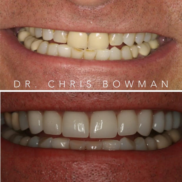 Images Advanced Dentistry of Charlotte
