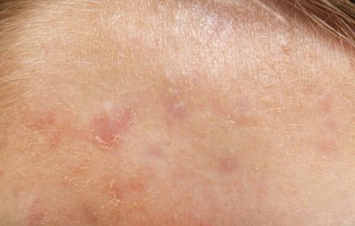 Images Marcucci Dr. Giampaolo Dermatologo
