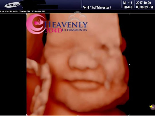 Images Heavenly 3D 4D Ultrasounds