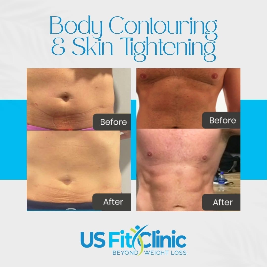 body contouring 