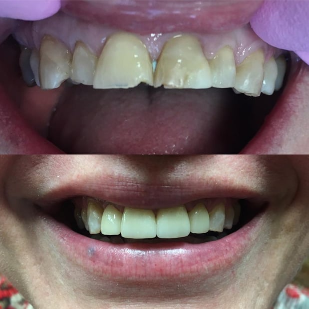 Images Columbia Dental