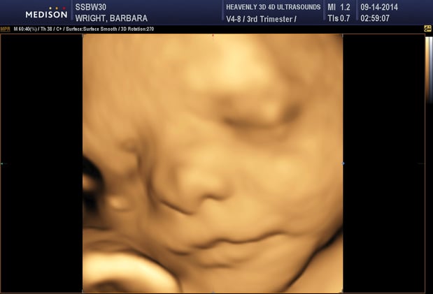 Images Heavenly 3D 4D Ultrasounds-Upland