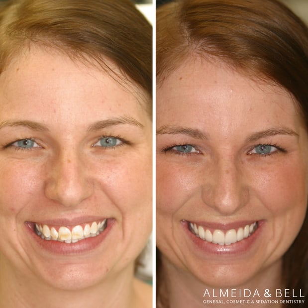 Images Almeida & Bell Dental Lone Tree - General, Cosmetic, and Implant Dentistry