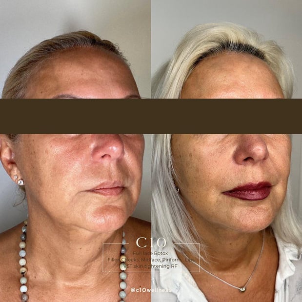 Images C10 Wellness and Rejuvenation