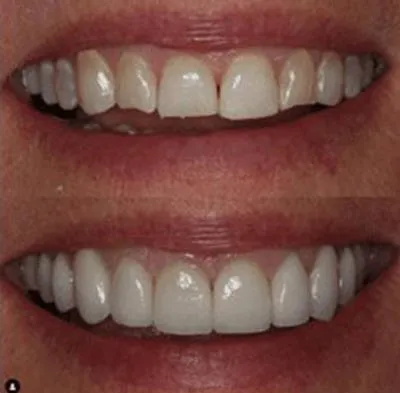 Images D'Angelo/Hoffman/Olson La Jolla Dentistry