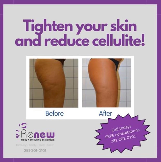 Images Renew Body Contouring & MedSpa