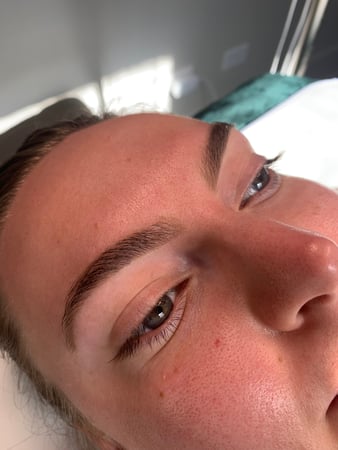 Images Gold Rush Esthetics