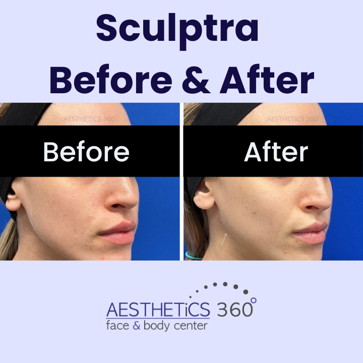 Images AESTHETICS 360° Face & Body Center