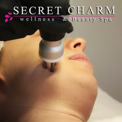 Images Secret Charm