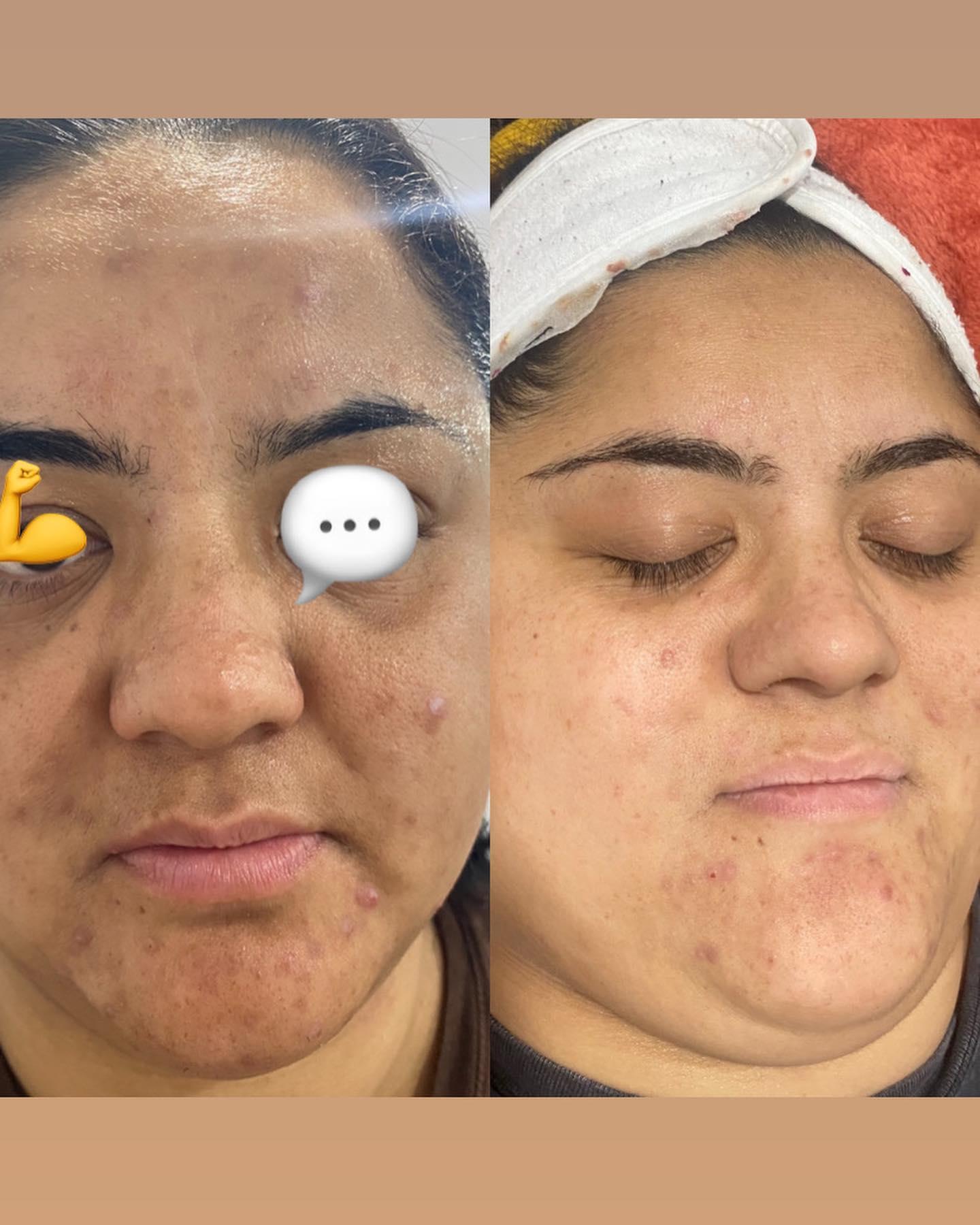 Images Luminous Skin