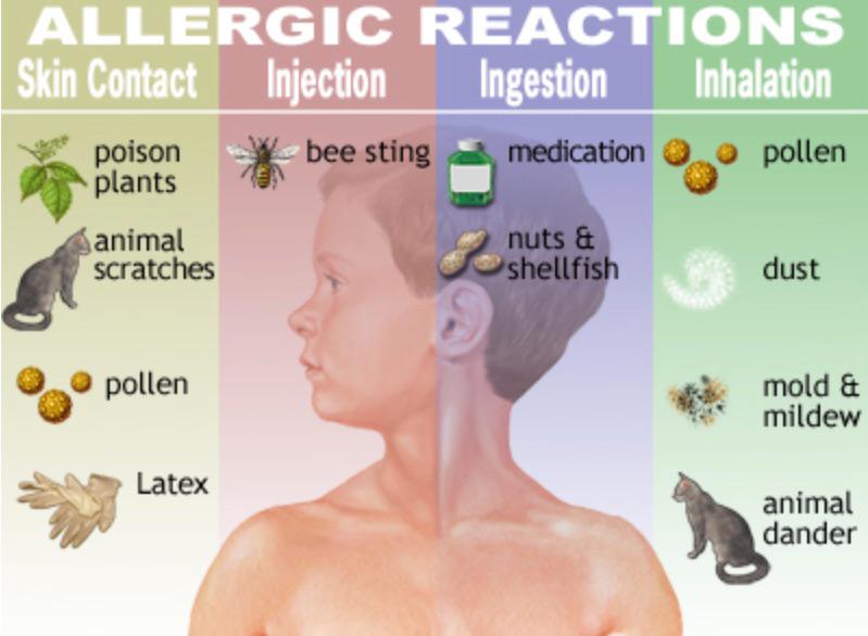 Images Gupta Allergy: Allergy & Asthma Specialists of Lansing, PLLC