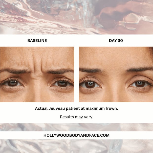 Images Hollywood Body & Face Colorado Springs