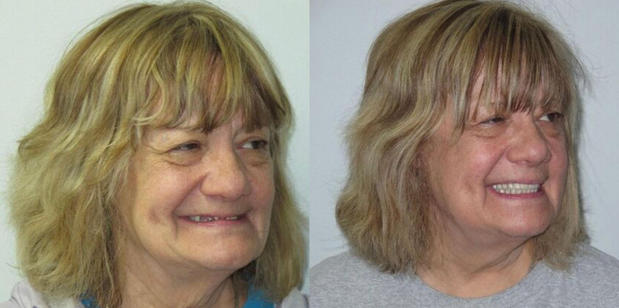 Images Staten Island Aesthetic & Implant Dentist