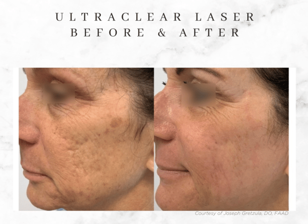 Images Supriya Aesthetic Dermatology