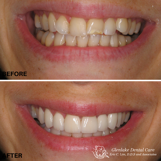 Images Glenlake Dental Care