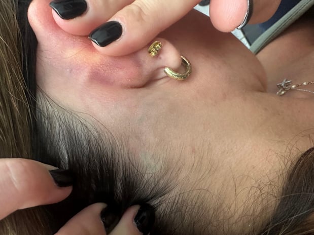 Images TruCanvas Aesthetics