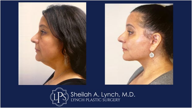 Images Dr. Sheilah A. Lynch
