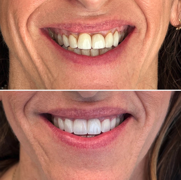Images Skyline Dental Designs | General and Cosmetic Dentistry