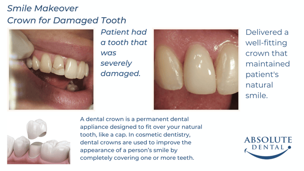 Images Absolute Dental
