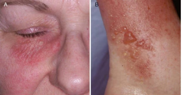 Images Gupta Allergy: Allergy & Asthma Specialists of Lansing, PLLC