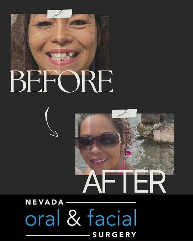 Images Nevada Oral & Facial Surgery - Henderson, NV