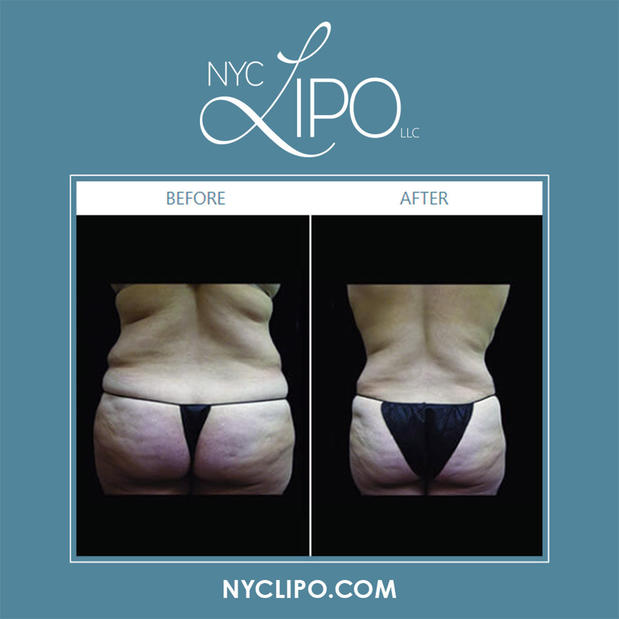 Images NYC Lipo LLC