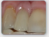 Foto's Tandtechnisch Laboratorium Dental Dokkum