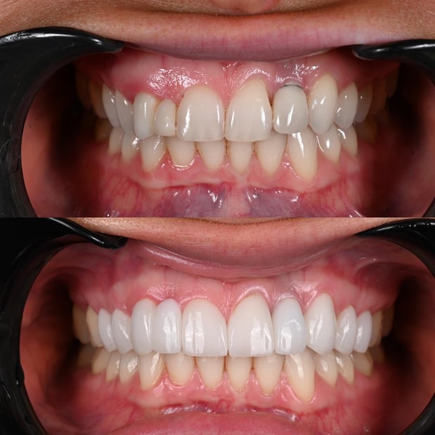 Images Nashville Wisdom Teeth and Implant Solutions