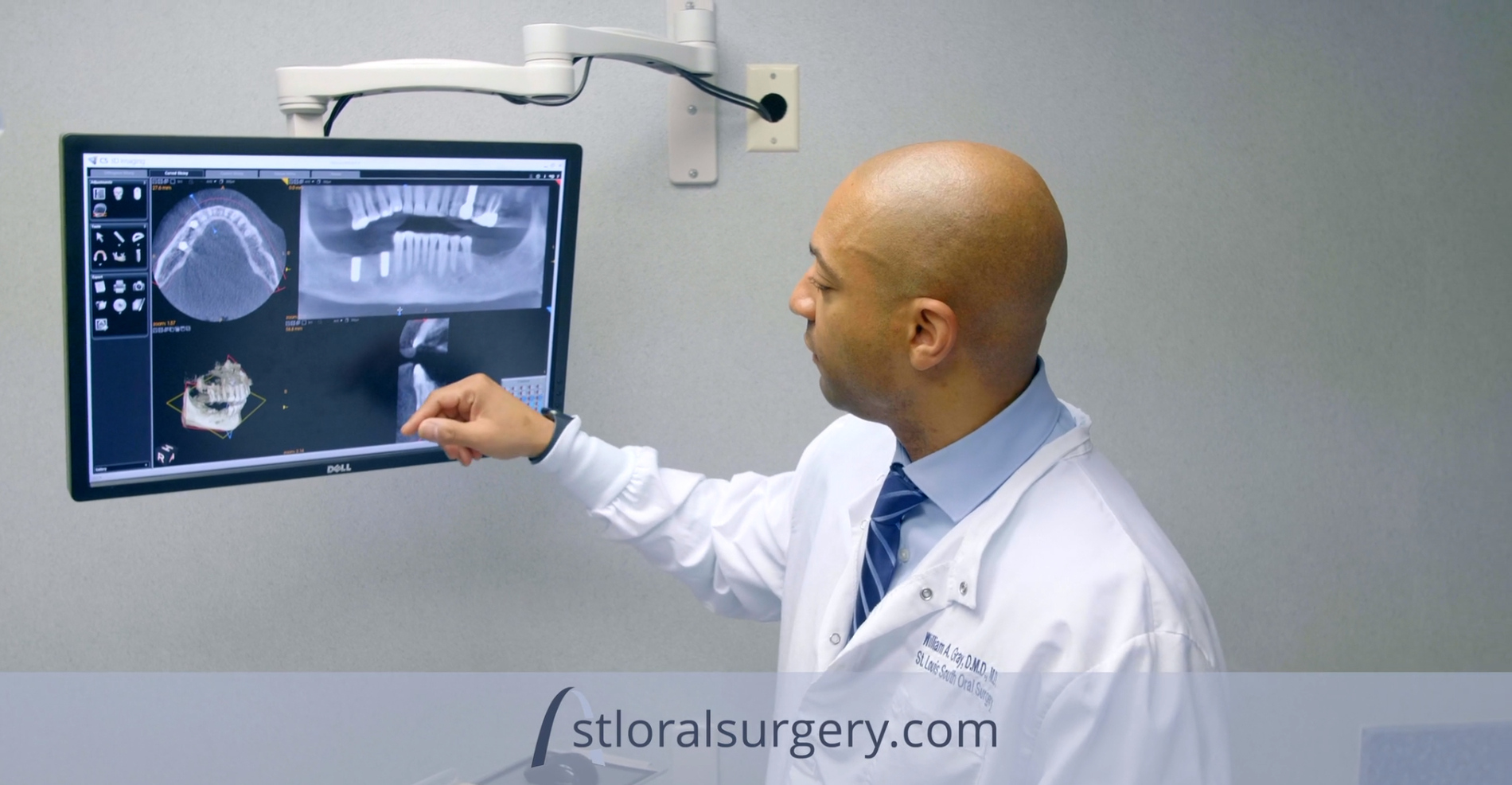 Image 6 | St. Louis South Oral Surgery