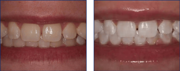 Images Preference Dental (Mecosta)