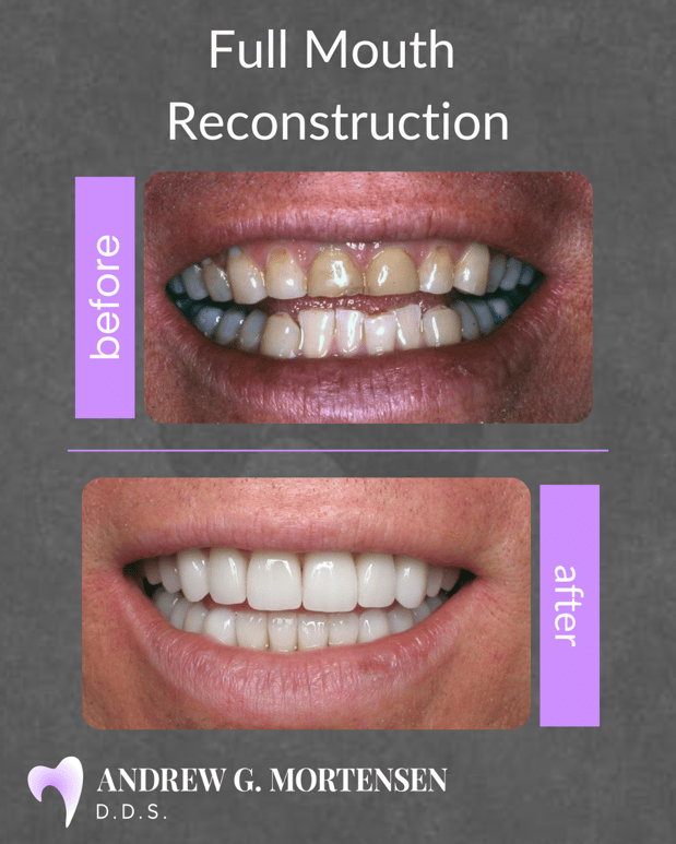 Images Andrew G. Mortensen, DDS