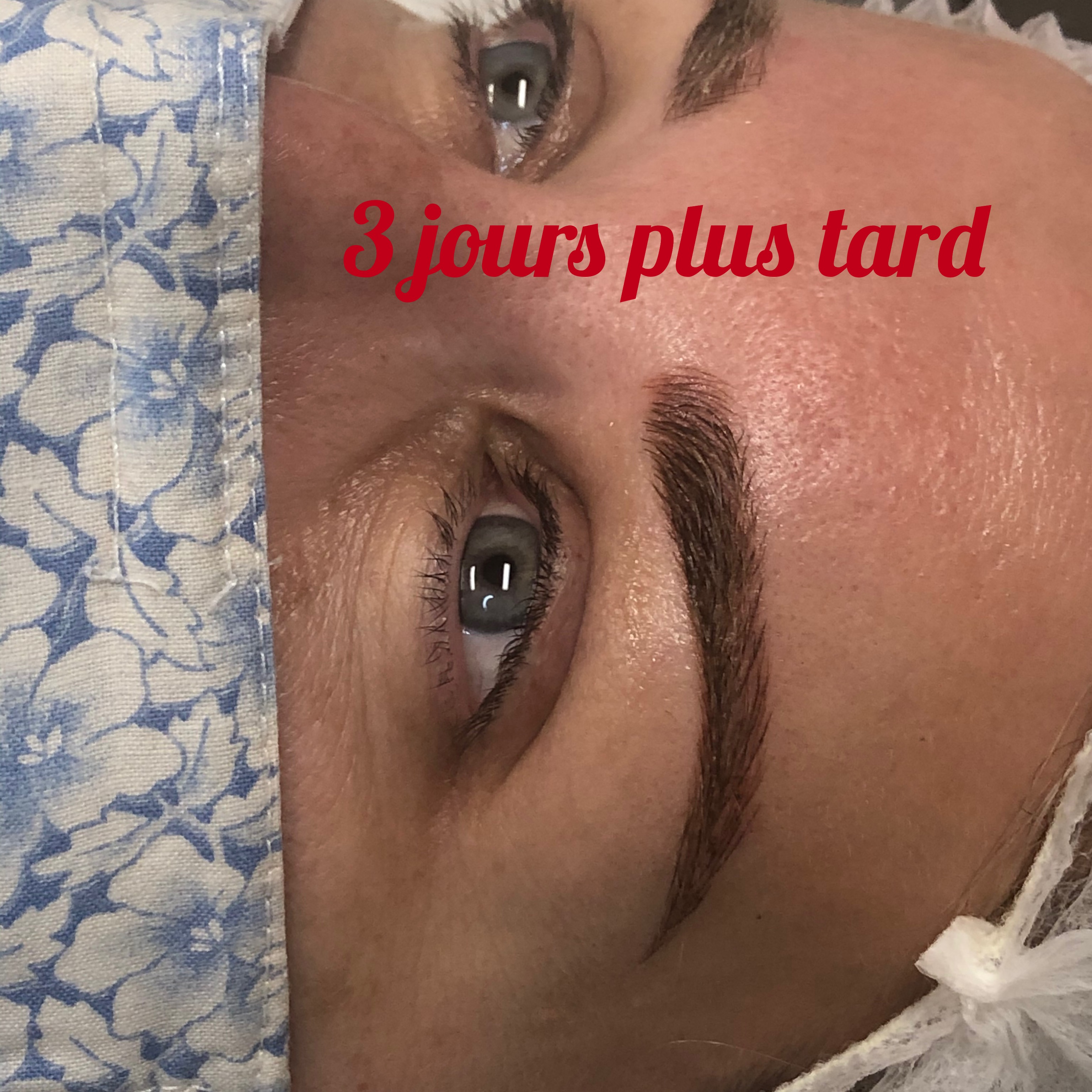 Images Clinique d'Esthétique Leila - Hydrafacial, Microblading, Épilation Laser Sainte-Foy