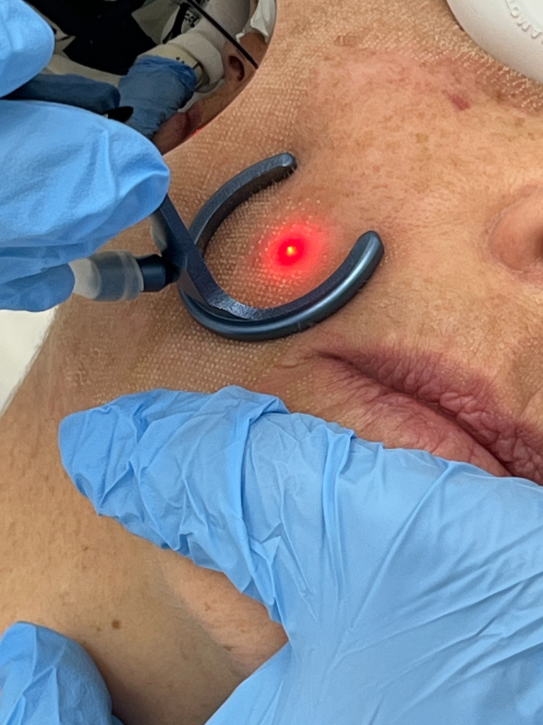 Images Dra. Silvia Solà. Medicina Estética y Láser