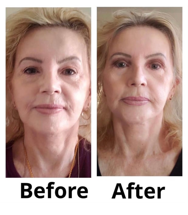 Images Dr. George Brennan - Cosmetic Surgeon Newport Beach