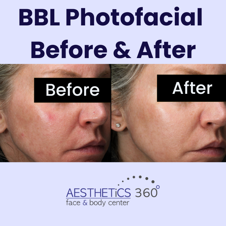 Images AESTHETICS 360° Face & Body Center