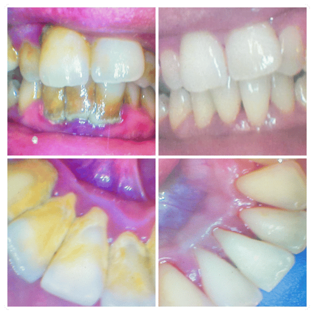 Images Agape Dental