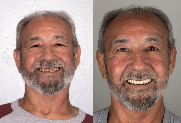 Images Hoopes Dental