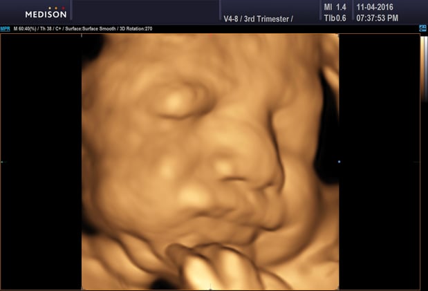 Images Heavenly 3D 4D Ultrasounds